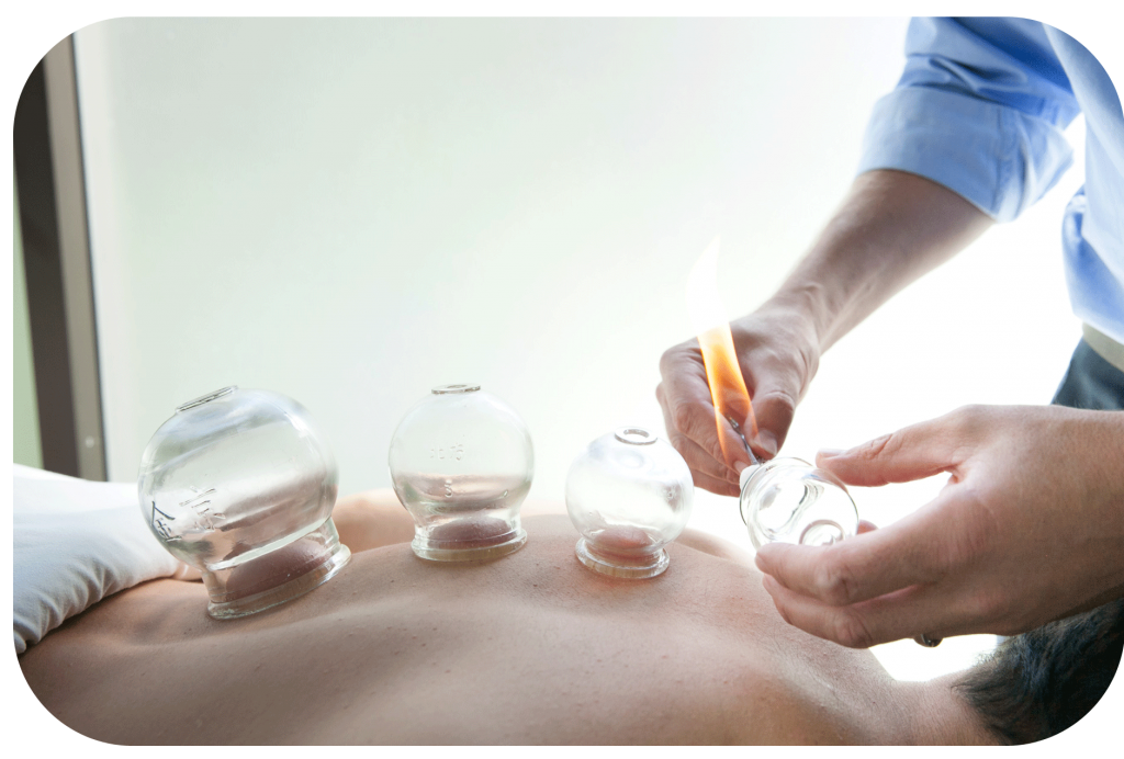 The Benefits of Hijama – Cupping Therapy