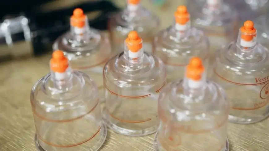 Cupping therapy (Hijama)